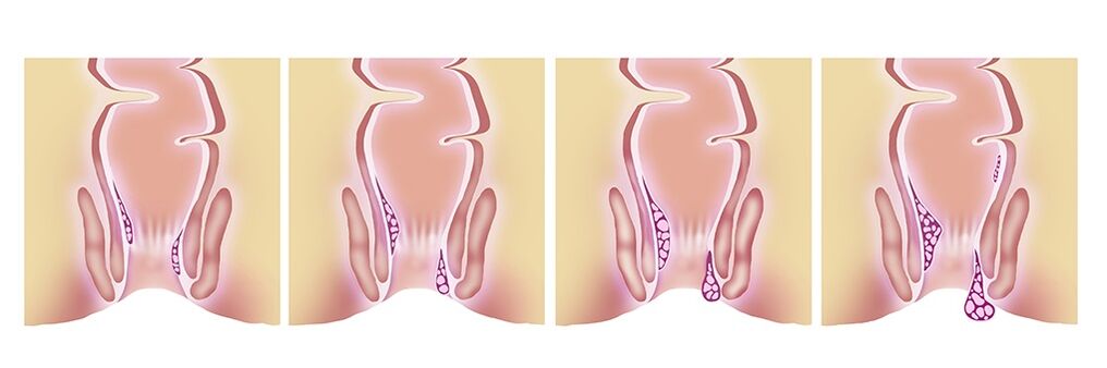 Gelarex effective at all stages